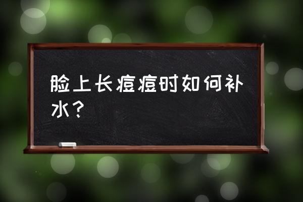 痘痘肌的好习惯 脸上长痘痘时如何补水? 痘痘肌的好习惯 脸上长痘痘时如何补水?