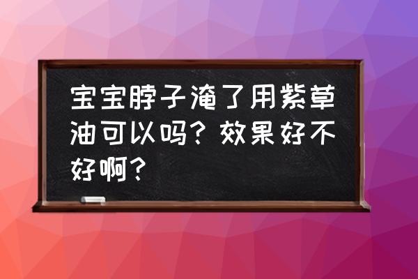 婴儿哪种牌子的紫草油好用 宝宝脖子淹了用紫草油可以吗?效果好不好啊? 婴儿哪种牌子的紫草油好用 宝宝脖子淹了用紫草油可以吗?效果好不好啊?